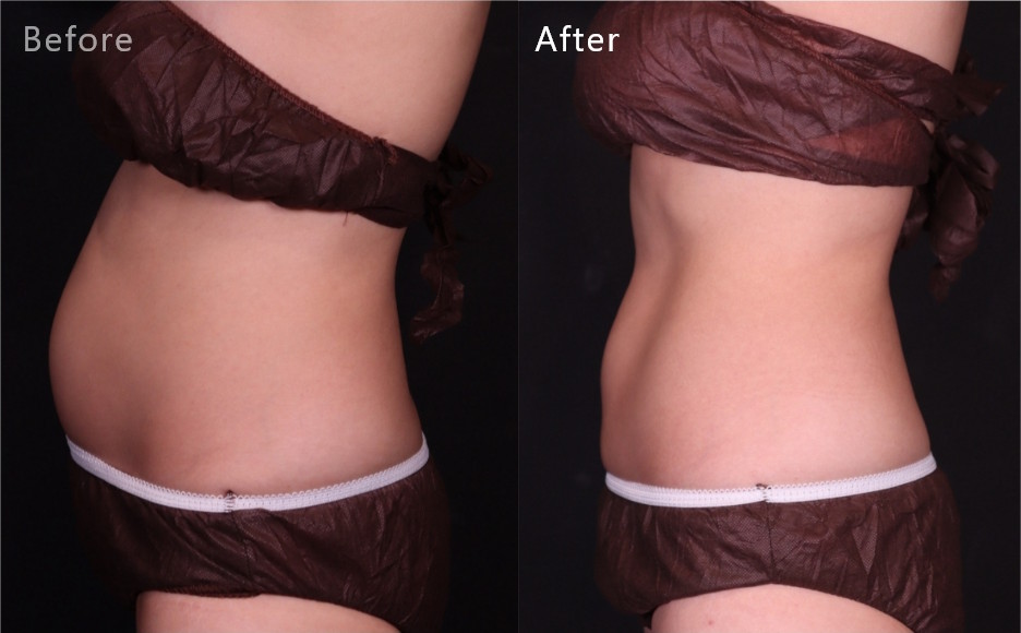 症例写真1（Before/After）