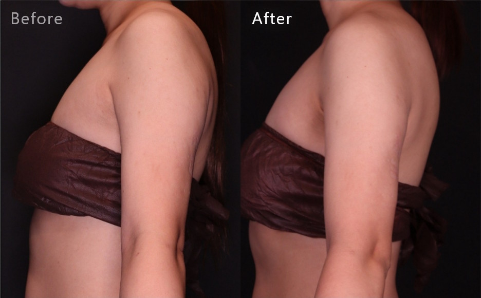 症例写真2（Before/After）