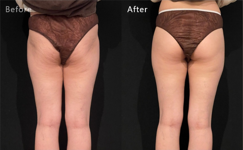 症例写真4（Before/After）