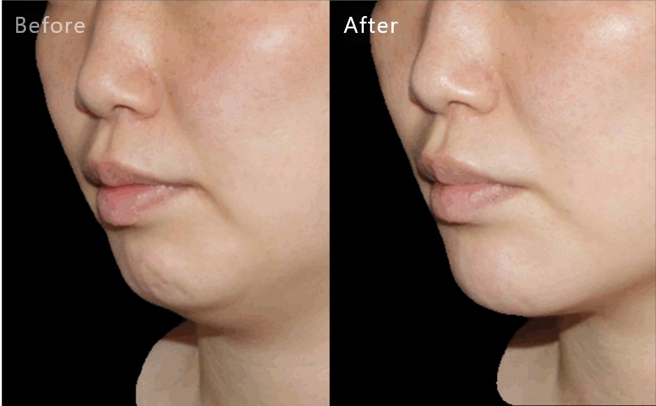 症例写真7（Before/After）